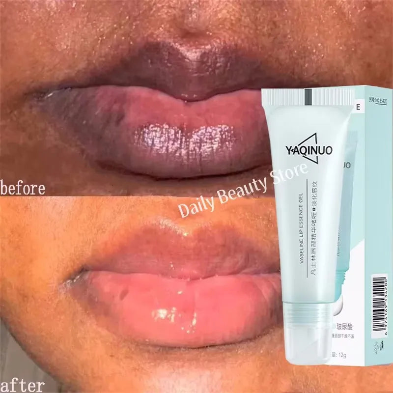 Remove Dark Lip Balm Fast Lightening Pink Lip Exfoliating Fade Lip Line Dead Skin Moisturizer Korean Care Products Beauty Health